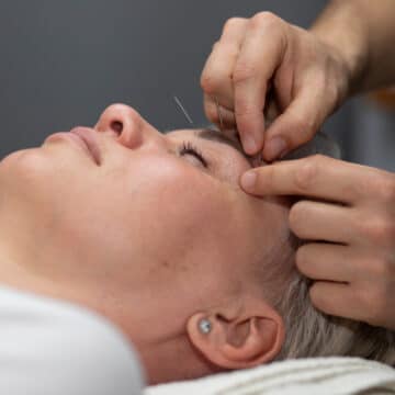 Can acupuncture make your face look younger?