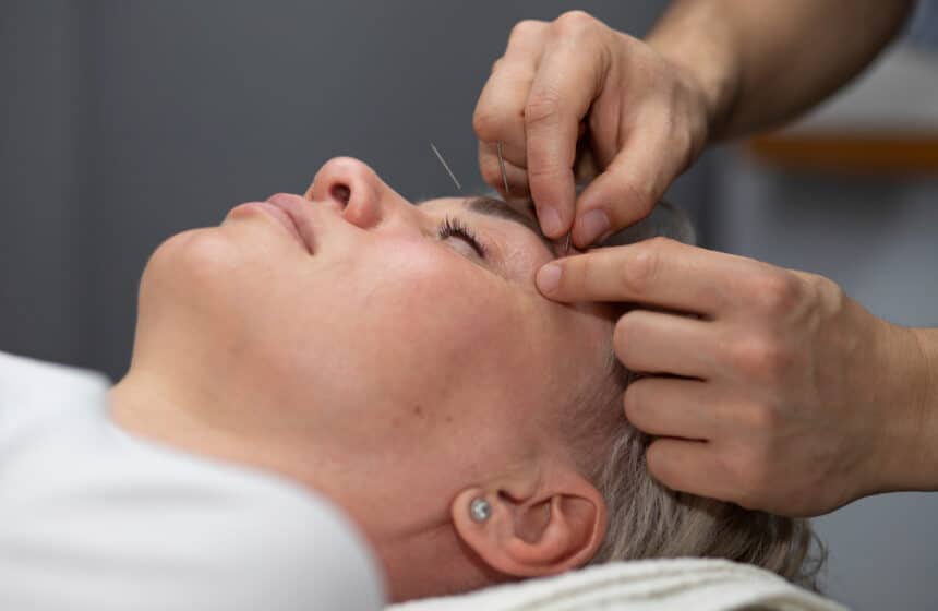 Can acupuncture make your face look younger?