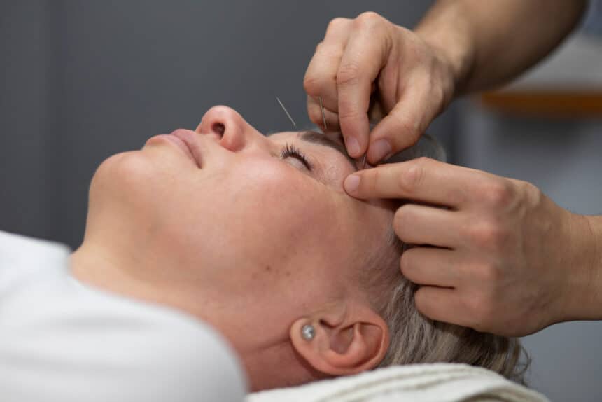 Can acupuncture make your face look younger?