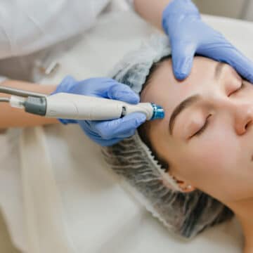 What will micro needling do to my face?